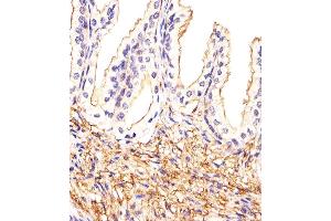 Immunohistochemical analysis of paraffin-embedded H. (ATF6B anticorps  (C-Term))