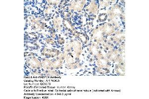 Rabbit Anti-PABPC4 Antibody  Paraffin Embedded Tissue: Human Kidney Cellular Data: Epithelial cells of renal tubule Antibody Concentration: 4. (PABPC4 anticorps  (N-Term))