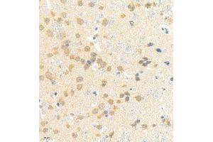 Immunohistochemistry of paraffin embedded rat brain using rasgrf1 (ABIN7073422) at dilution of 1:4000 (400x lens) (Cdc25 anticorps)