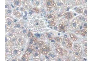 DAB staining on IHC-P; Samples: Mouse Liver Tissue