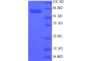 SDS-PAGE (SDS) image for ADP-Ribosyltransferase 1 (ART1) (AA 23-295) protein (GST tag) (ABIN5709085)