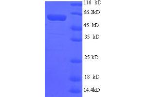 SDS-PAGE (SDS) image for ADP-Ribosyltransferase 1 (ART1) (AA 23-295) protein (GST tag) (ABIN5709085) (ART1 Protein (AA 23-295) (GST tag))
