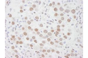 Immunohistochemistry (IHC) image for anti-DEAD (Asp-Glu-Ala-Asp) Box Polypeptide 1 (DDX1) (AA 500-550) antibody (ABIN7448512) (DDX1 anticorps  (AA 500-550))