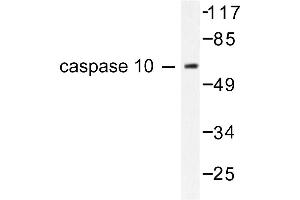 Image no. 1 for anti-Caspase 10, Apoptosis-Related Cysteine Peptidase (CASP10) antibody (ABIN265334) (Caspase 10 anticorps)