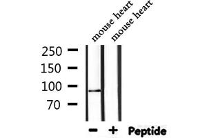 Western blot analysis of extracts from mouse heart, using TOP1 Antibody. (Topoisomerase I anticorps  (Internal Region))