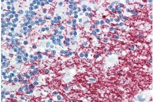 Human Brain, Cerebellum (formalin-fixed, paraffin-embedded) stained with PLP1 antibody ABIN364261 at 10 ug/ml followed by biotinylated anti-mouse IgG secondary antibody ABIN481714, alkaline phosphatase-streptavidin and chromogen.