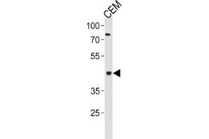 Western Blotting (WB) image for anti-Fatty Acid Desaturase 2 (FADS2) antibody (ABIN3002322) (FADS2 anticorps)