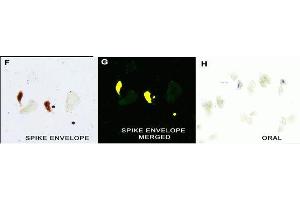 IHC Validation in COVID-19 Patient Sample: (Nuovo et al. (SARS-CoV-2 Envelope anticorps  (N-Term))