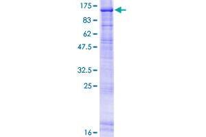 Image no. 1 for DNA Repair Protein Complementing XP-B Cells (ERCC3) (AA 1-782) protein (GST tag) (ABIN1353035)