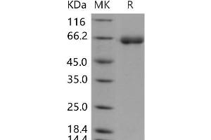 Western Blotting (WB) image for Dipeptidyl-Peptidase 7 (DPP7) (Active) protein (His tag) (ABIN7195432)