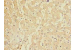 Immunohistochemistry of paraffin-embedded human liver tissue using ABIN7154473 at dilution of 1:100