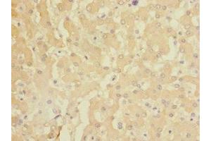 Immunohistochemistry of paraffin-embedded human liver tissue using ABIN7154473 at dilution of 1:100 (GADD45G anticorps  (AA 1-159))