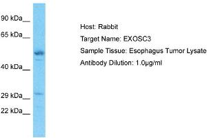 Host: Rabbit Target Name: EXOSC3 Sample Type: Esophagus Tumor lysates Antibody Dilution: 1. (EXOSC3 anticorps  (C-Term))