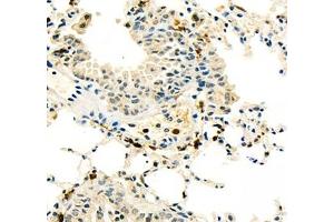 Immunohistochemistry of paraffin embedded mouse lung using BIRC3 (ABIN7073179) at dilution of 1: 1800 (400x lens)