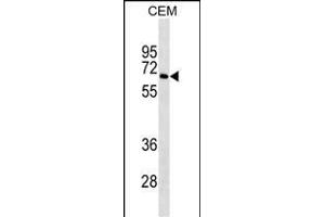 BLNK Antibody ABIN1539928 western blot analysis in CEM cell line lysates (35 μg/lane). (B-Cell Linker anticorps  (AA 150-178))