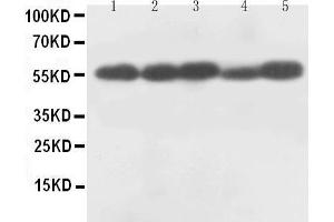 Western Blotting (WB) image for anti-Caspase 8 (CASP8) (AA 240-259), (Middle Region) antibody (ABIN3044361)