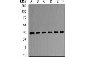 Western blot analysis of Transaldolase expression in HEK293T (A), A431 (B), SW480 (C), mouse brain (D), mouse kidney (E), rat liver (F) whole cell lysates. (TALDO1 anticorps)