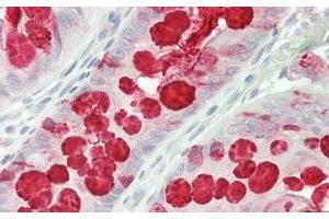 Detection of TFF3 in Human Colon Tissue using Polyclonal Antibody to Trefoil Factor 3 (TFF3)