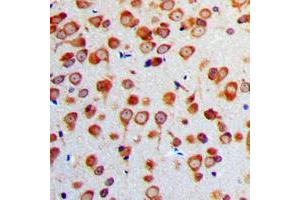 Immunohistochemical analysis of Gamma-enolase staining in human brain formalin fixed paraffin embedded tissue section.