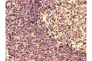 Immunohistochemistry analysis of human tonsil tissue using ABIN7143089 at dilution of 1:100