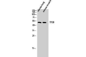 Western Blotting (WB) image for anti-Transcription Factor EB (TFEB) (N-Term) antibody (ABIN3177684) (TFEB anticorps  (N-Term))