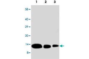 Western blot analysis of recombinate human CXCL9 protein with CXCL9 polyclonal antibody . (CXCL9 anticorps  (N-Term))