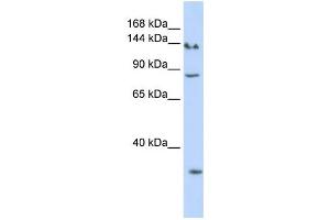 Western Blotting (WB) image for anti-SIN3 homolog A, transcription regulator (SIN3A) antibody (ABIN2457956) (SIN3A anticorps)