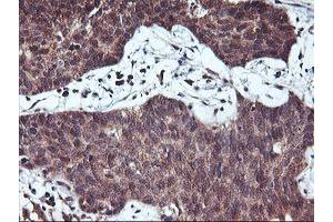 Image no. 5 for anti-Haloacid Dehalogenase-Like Hydrolase Domain Containing 1 (HDHD1) antibody (ABIN1498625) (HDHD1 anticorps)
