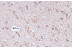 Immunohistochemistry of paraffin-embedded Rat brain using CARTPT Polyclonal Antibody at dilution of 1:100 (40x lens). (CARTPT anticorps)
