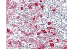 Formalin-fixed and paraffin-embedded H.