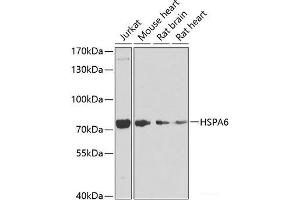 Western blot analysis of extracts of various cell lines using HSPA6 Polyclonal Antibody at dilution of 1:1000. (HSPA6 anticorps)