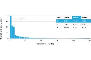 Analysis of Protein Array containing more than 19,000 full-length human proteins using Dystrophin Monospecific Mouse Monoclonal Antibody (DMD/3245).