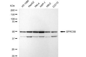 Western blotting analysis using GPRC5B antibody (ABIN7798676).