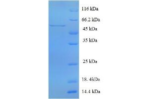 Multiple Inositol-Polyphosphate Phosphatase 1 (MINPP1) (AA 31-481) protein (His tag)