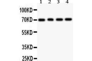 Anti- FOXO1A antibody, Western blotting All lanes: Anti FOXO1A  at 0.