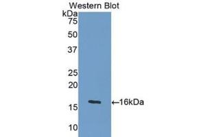 Western blot analysis of the recombinant protein. (GDF5 anticorps  (AA 382-501))