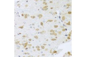 Immunohistochemistry of paraffin-embedded mouse brain using Gm13125 antibody. (Pramel15 anticorps  (AA 67-274))