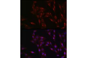 Immunofluorescence analysis of NIH/3T3 cells using MR1 Rabbit pAb (ABIN6131925, ABIN6143983, ABIN6143984 and ABIN6224070) at dilution of 1:100 (40x lens). (MR1 anticorps  (AA 20-260))