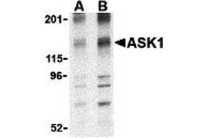 Western Blotting (WB) image for anti-Mitogen-Activated Protein Kinase Kinase Kinase 5 (MAP3K5) (N-Term) antibody (ABIN1031241) (ASK1 anticorps  (N-Term))