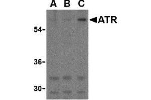 Western Blotting (WB) image for anti-ATR serine/threonine kinase (ATR) (C-Term) antibody (ABIN1030269)