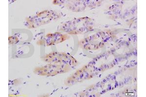 Formalin-fixed and paraffin embedded mouse stomach tissue labeled with Anti-Tenascin C/Tn-C Polyclonal Antibody, Unconjugated (ABIN736761) at 1:200 followed by conjugation to the secondary antibody and DAB staining