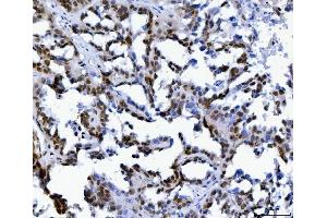 IHC analysis of MBNL1 using anti-MBNL1 antibody (ABIN7602608). (MBNL1 anticorps  (AA 89-388))