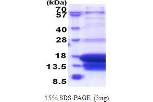 SDS-PAGE (SDS) image for Death-Associated Protein (DAP) (AA 1-102) protein (His tag) (ABIN6387467)