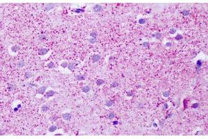 Human, Brain, Cortex, Neurons:  Formalin-Fixed Paraffin-Embedded (FFPE)