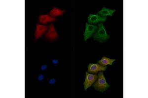 ABIN7094675 and ABIN7098726 staining Hela cells by IF/ICC. (ART4 anticorps  (N-Term))