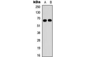 Western blot analysis of DDX52 expression in HEK293T (A), Raji (B) whole cell lysates. (DDX52 anticorps  (C-Term))
