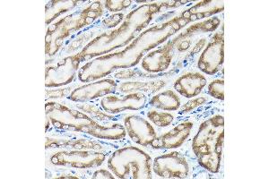 Immunohistochemistry of paraffin-embedded rat brain using NLRP1 Rabbit pAb (ABIN7268935) at dilution of 1:100 (40x lens).