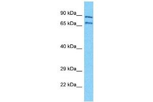 Western Blotting (WB) image for anti-Neuroblastoma Breakpoint Family, Member 11 (NBPF11) (Middle Region) antibody (ABIN2791692) (NBPF11 anticorps  (Middle Region))