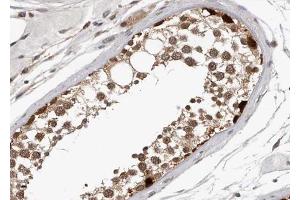 ABIN6267348 at 1/100 staining human Testis tissue sections by IHC-P. (MYB anticorps  (pSer532))
