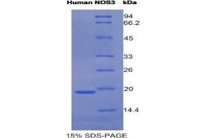 SDS-PAGE analysis of Human NOS3 Protein. (ENOS Protéine)